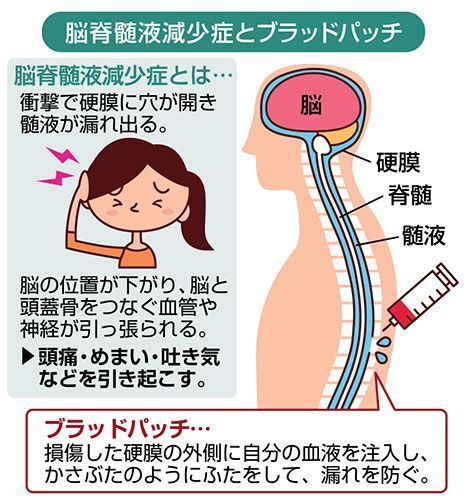 脳脊髄液減少症 に負けるもんか