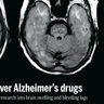 重い副作用への懸念強く　アルツハイマー病薬「レカネマブ」