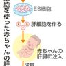 ＥＳ製品、承認申請へ　国内初　肝臓病の赤ちゃん治療