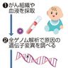 小児がん　全ゲノム解析へ　最適診断、治療法を確定　２０病院、有効性検証