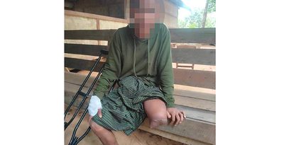 地雷で片足失った弟、通話中響く銃撃音…　在沖ミャンマー人の男性「故郷を知り支援を」　ミャンマー政変3年